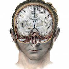 Head of a man cut away along the frontal & transverse planes, exposing a cross-section of the brain