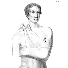 Medical plate showing a man wearing clavicle and inguinal bandages