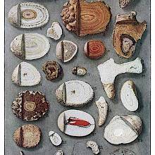 Color plate showing the cross section of various kidney and bladder stones.