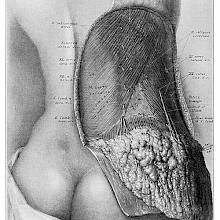 Medical plate showing a woman's back with an écorché view of the lumbar region