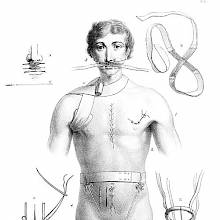 Medical plate showing a man bearing various kind of sutures and wearing miscellaneous bandages