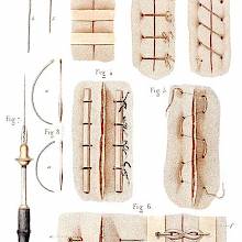 Examples of different types of sutures and the instruments required to use them.