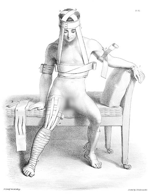 Medical plate showing a sitting man wearing a variety of bandages on his limbs, chest, and head