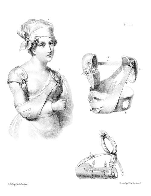 A woman is wearing her arm in a sling as bandages and slings can be seen depicted on the same page