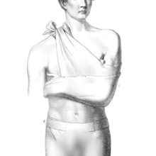 Medical plate showing a man wearing clavicle and inguinal bandages