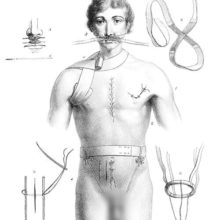 Medical plate showing a man bearing various kind of sutures and wearing miscellaneous bandages
