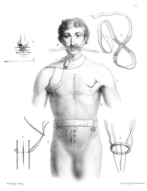 Medical plate showing a man bearing various kind of sutures and wearing miscellaneous bandages